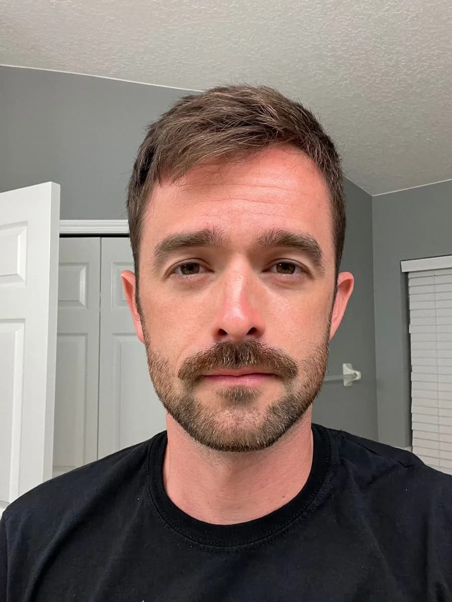 Before — Transformation 3